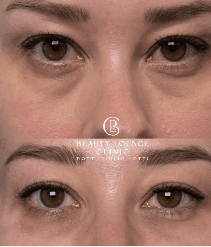 Screenshot 2025-11-07 alle 13.56.20 | Dott.GIulio Lotti Protocollo Sguardo fresco- Dott. Giulio Lotti