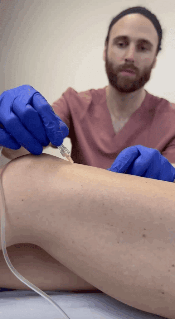 Carbossiterapia per eliminare la cellulite e migliorare glutei e cosce – Dott. Giulio Lotti