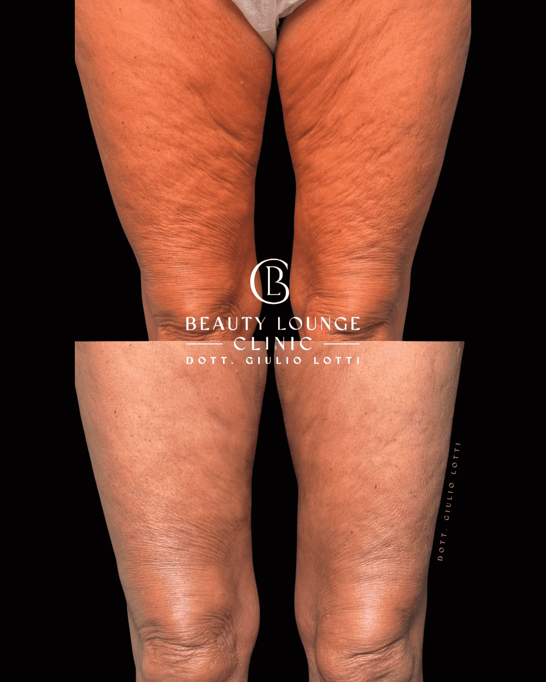 Illustrazione cause gambe gonfie e pesanti